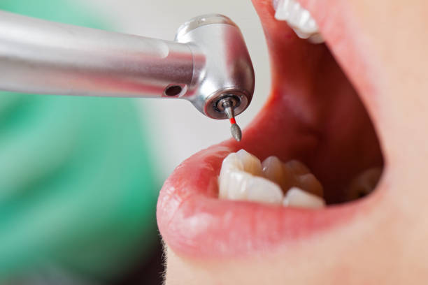 Best Cosmetic Emergency Dentistry in Ridgeland, MS
